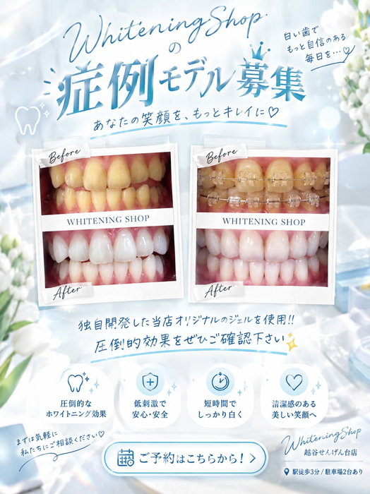 画像1302