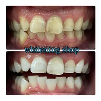 画像360