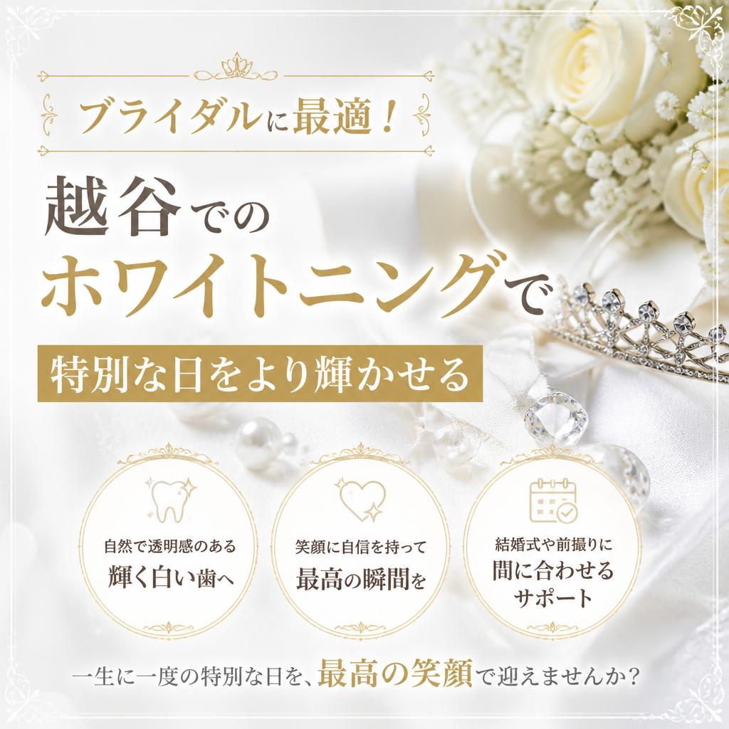ブライダルに最適！越谷でのホワイトニングで特別な日をより輝かせる