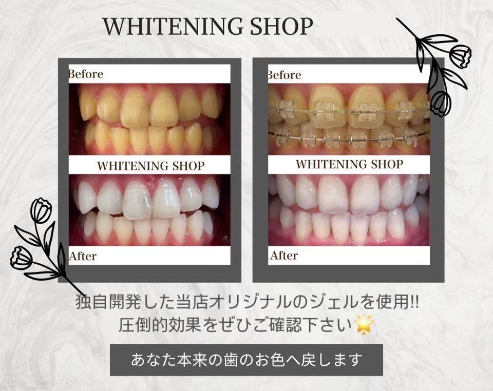 今すぐお問合せを！